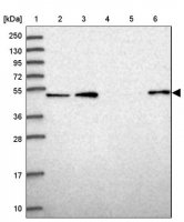 Anti-WSCD2 antibody produced in rabbit 