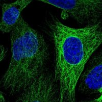 Anti-WWC2 antibody produced in rabbit 