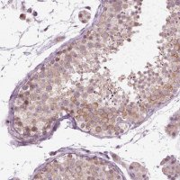 Anti-XK antibody produced in rabbit 