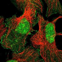Anti-XPO6 antibody produced in rabbit 