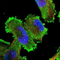 Anti-XRN1 antibody produced in rabbit 