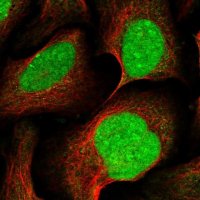 Anti-XRN2 antibody produced in rabbit 
