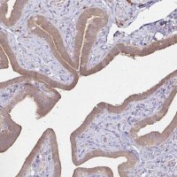 Anti-YAP1 antibody produced in rabbit 