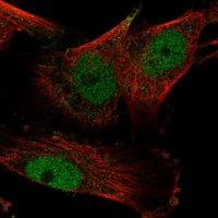 Anti-YEATS2 antibody produced in rabbit 