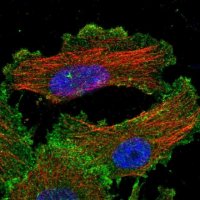 Anti-YES1 antibody produced in rabbit 