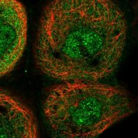 Anti-YOD1 antibody produced in rabbit 