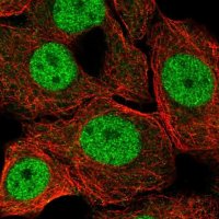 Anti-ZBTB14 antibody produced in rabbit 