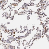 Anti-ZBTB16 antibody produced in rabbit 