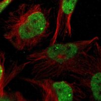 Anti-ZBTB20 antibody produced in rabbit 