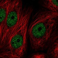 Anti-ZBTB21 antibody produced in rabbit 