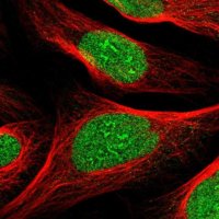Anti-ZBTB43 antibody produced in rabbit 