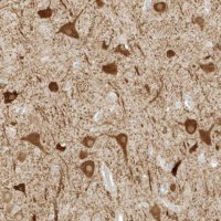 Anti-ZBTB8A antibody produced in rabbit 