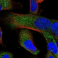 Anti-ZCCHC11 antibody produced in rabbit 