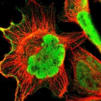 Anti-ZCCHC16 antibody produced in rabbit 
