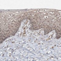Anti-ZCCHC4 antibody produced in rabbit 