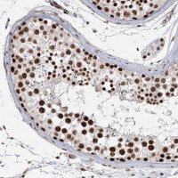 Anti-ZCCHC8 antibody produced in rabbit 