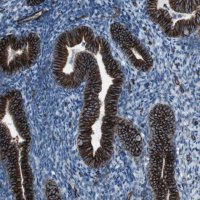 Anti-ZDHHC6 antibody produced in rabbit 