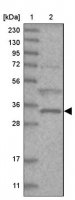 Anti-ZFAND2B antibody produced in rabbit HPA035159-100UL
