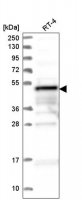 Anti-ZFYVE19 antibody produced in rabbit 