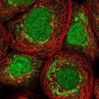 Anti-ZMAT2 antibody produced in rabbit HPA036518-100UL