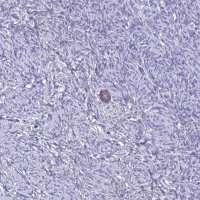 Anti-ZMIZ1 antibody produced in rabbit 