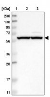 Anti-ZMYM5 antibody produced in rabbit 