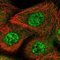 Anti-ZNF160 antibody produced in rabbit 