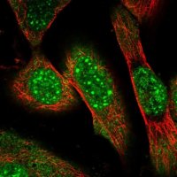 Anti-ZNF169 antibody produced in rabbit 