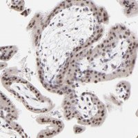 Anti-ZNF177 antibody produced in rabbit 