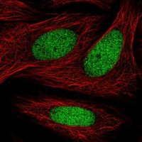 Anti-ZNF182 antibody produced in rabbit 