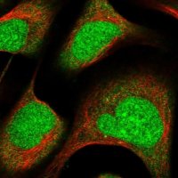 Anti-ZNF195 antibody produced in rabbit 