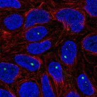 Anti-ZNF226 antibody produced in rabbit 