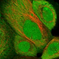 Anti-ZNF276 antibody produced in rabbit 