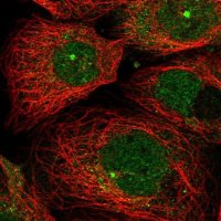Anti-ZNF280D antibody produced in rabbit 
