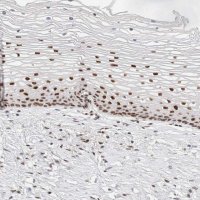 Anti-ZNF282 antibody produced in rabbit 