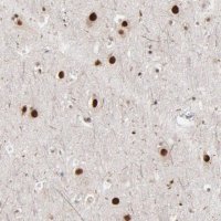 Anti-ZNF3 antibody produced in rabbit 