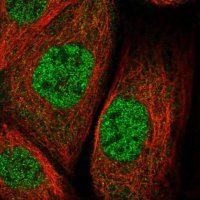 Anti-ZNF30 antibody produced in rabbit 