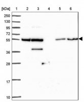 Anti-ZNF300 antibody produced in rabbit HPA051777-100UL
