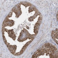 Anti-ZNF354C antibody produced in rabbit 