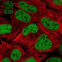 Anti-ZNF420 antibody produced in rabbit 