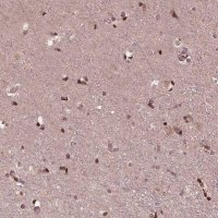 Anti-ZNF471 antibody produced in rabbit HPA066695-100UL