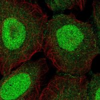 Anti-ZNF497 antibody produced in rabbit 