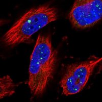 Anti-ZNF514 antibody produced in rabbit 