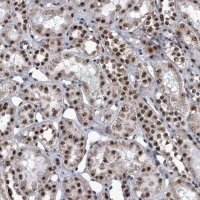 Anti-ZNF518B antibody produced in rabbit 