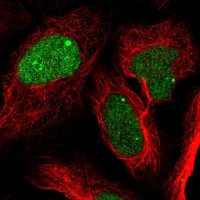 Anti-ZNF565 antibody produced in rabbit HPA044123-100UL