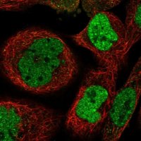 Anti-ZNF570 antibody produced in rabbit 
