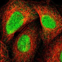 Anti-ZNF589 antibody produced in rabbit 