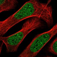 Anti-ZNF613 antibody produced in rabbit 