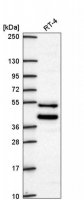 Anti-ZNF621 antibody produced in rabbit HPA071440-100UL