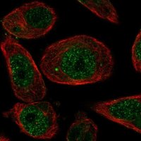 Anti-ZNF623 antibody produced in rabbit 